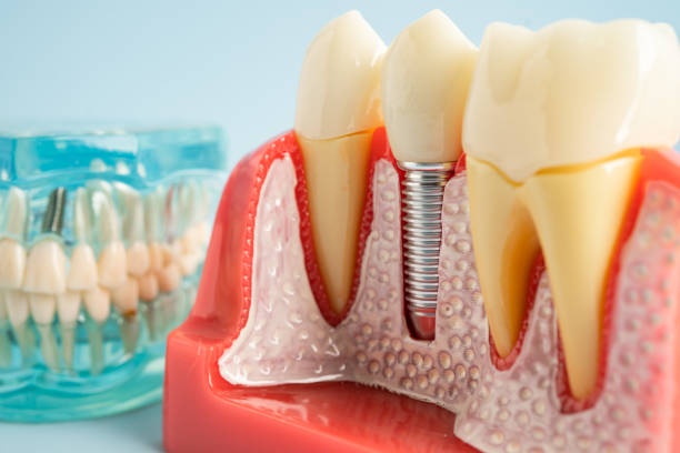 Our Range of Dental Services in Omaha, TX