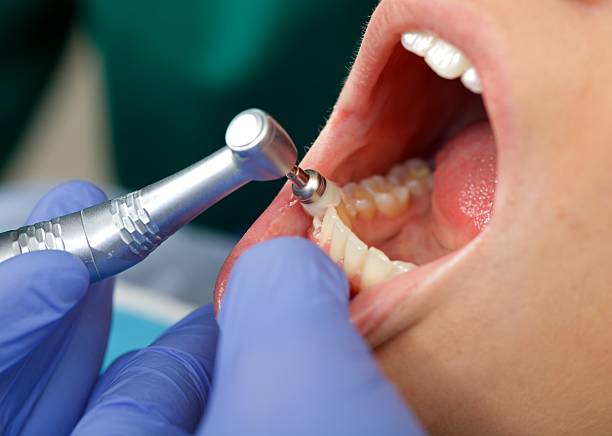 Best Dental Fillings (Composite and Amalgam)  in Omaha, TX